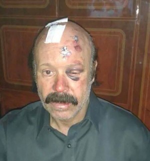 Fadil Azzabi after his beating (Photo: social media)