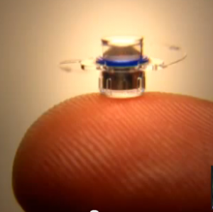 Tiny telescope that improves vision after implanted in the eye (screenshot taken from Harley Street Eye Associates video)