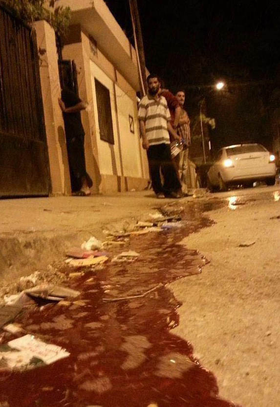 Blood runs in the street after rocket hits Major school housing refugees (Photo: Social media)